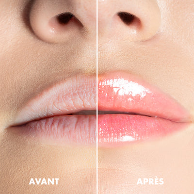 Looky Lips Peptide Therapy #4 Birthday Cake